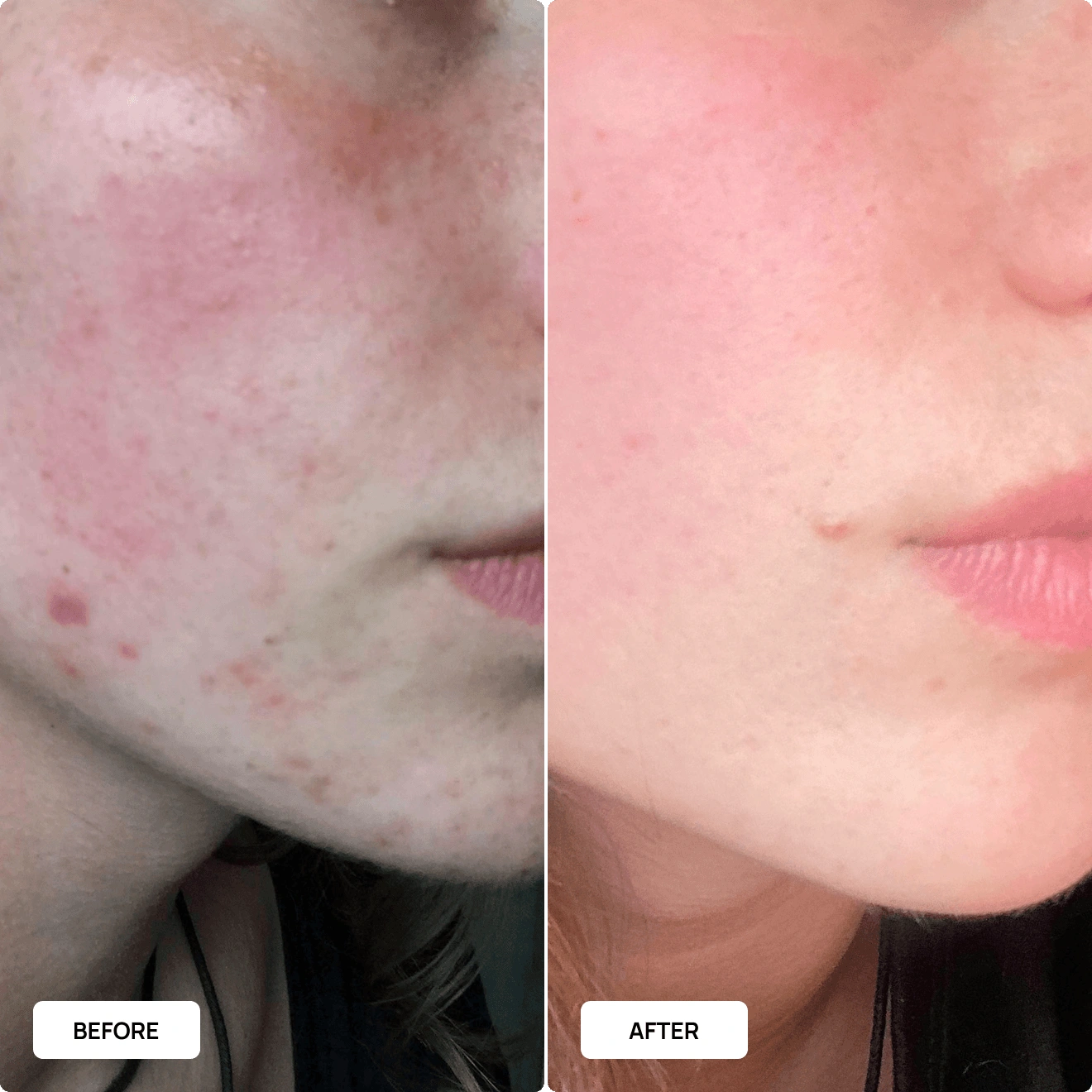 All skincare products before and after